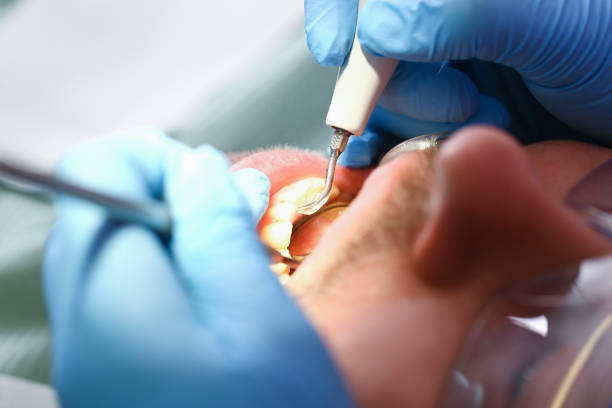 Best Emergency Dental Surgery in Parsons, WV